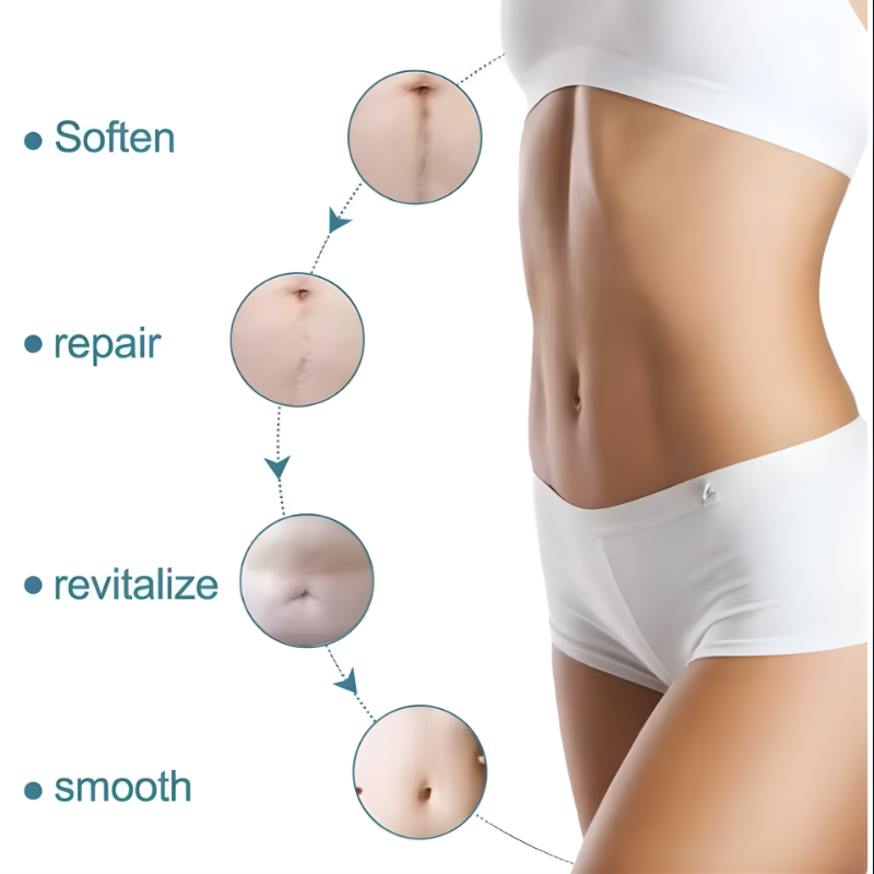 ScarEase™ Gel Repair Patch