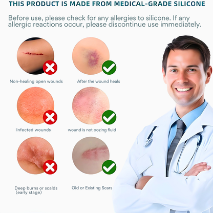 ScarEase™ Gel Repair Patch